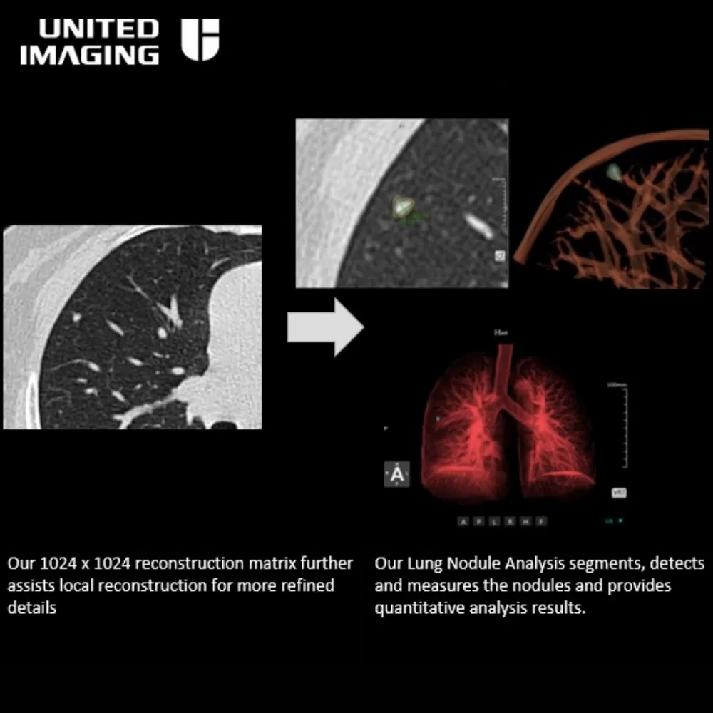 united imaging